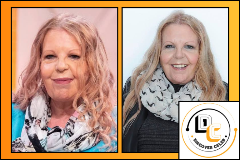 Sally Thomsett Face Illness: How a Rumor Outgrew the Facts Sally Thomsett Face Illness