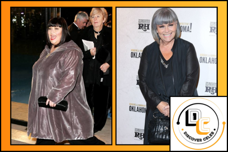 Dawn French Weight Loss
